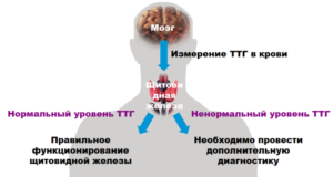 Завышены гормоны щитовидной железы