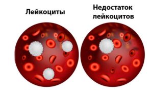 Снижение лейкоцитов до 2,68