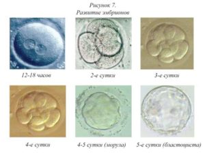 Эмбрионы останавливаются в развитии при ЭКО. Причины