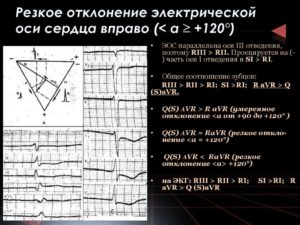 Отклонение ЭОС вправо