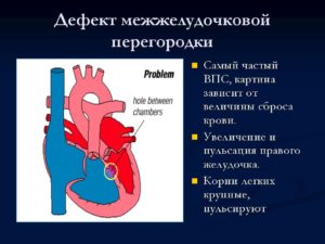 ВПС. ДМЖП. НК 1 ст. Возможно самостоятельное закрытие?