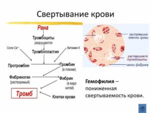 Низкая свертываемость крови