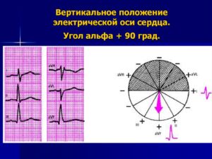 Вертикальное положение эос