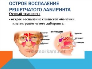 Завуалированность клеток решетчатого лабиринта