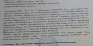 Помогите разобраться с КТ результатом