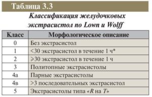 Экстрасистолия, нарушение ритма соответствует 4А классу градации ЖЭС по Лауну