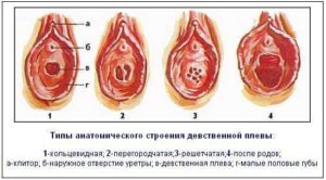 Как может растянутся девственная плева?