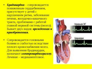 Брадикардия у ребенка