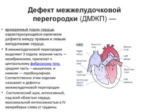 ВПС. ДМЖП. НК 1 ст. Возможно самостоятельное закрытие?