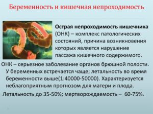 Непроходимость кишечника при беременности