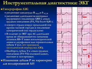 Зачем направляют на ЭКГ после рентгена грудного отдела