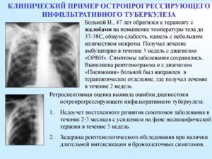 Возможно ли заражение туберкулезом при спирометрии - общий бронхолитик