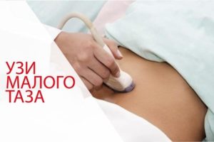Узи малого таза и алкоголь