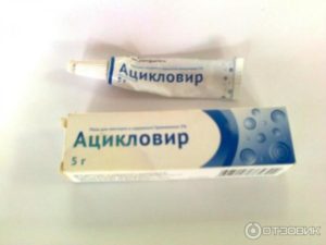 Местная реакция на ацикловир