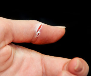 Незаживающая рана на пальце
