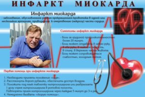 Отеки и одышка после инфаркта