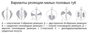 Строение малых половых губ