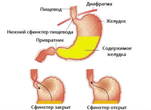 Заброс желчи в желудок