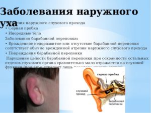 Болит ухо, сузился слуховой проход