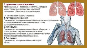 Боль и кашель в области лёгкого и кровь с мокротой