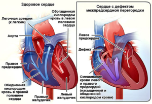 МАР сердца ДМПП ООО НКО