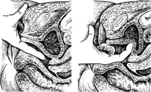 Зппп при введении пальцев во влагалище
