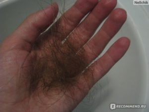 Выпадение волос после отмены ОК