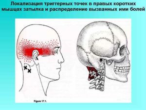 Болит лицо, глаз, висок и шея в основании черепа