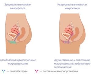 Выделения после Кольпоцида