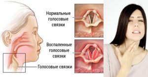 Чешется в горле в области языка и ухо