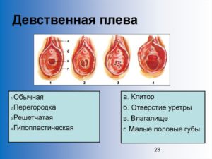 Нет удовольствия от секса после лишения девственности