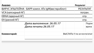 Помогите понять анализ на ВЭБ