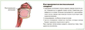 Мучеет скопление белой слизи на задней стенке горло