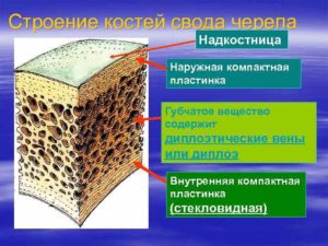 Периостит наружной кортикальной пластинки костей свода черепа