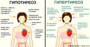 Признаки гипотиреоза при нормальных гормонах