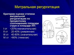 Результат УЗИ сердца: митральная регургитация 1 степени, трикуспидальная регургитация 1 степени