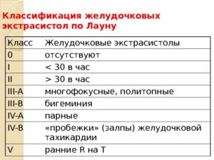 Экстрасистолия, нарушение ритма соответствует 4А классу градации ЖЭС по Лауну