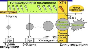 Стимуляция овуляции клостилбегитом при спкя