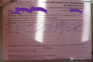 Узи малого таза и алкоголь