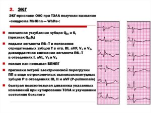 Зачем направляют на ЭКГ после рентгена грудного отдела