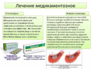 Чем лечить сухой кашель после инфаркта миокарда?