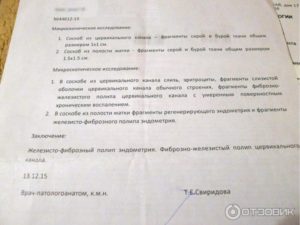 Результаты гистологии, полип эндометрия