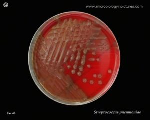 В посеве streptococcus pyogenes