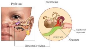 Сопли через уши