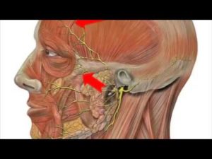 Болит голова и дергаются мышцы лица
