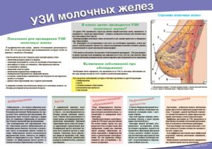 Профилактика по узи молочных желез