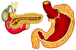 Панкреатит, гастрит или стресс