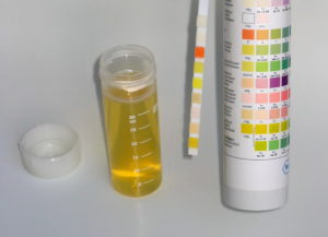 Можно ли сдавать Прозрачную мочу на лаборатнорный драг-тест