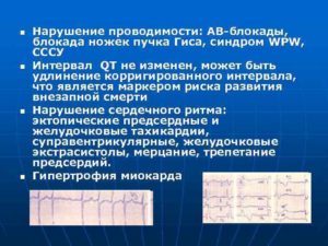 Замедление проведения хода возбуждения по правой ножке пучка Гиса