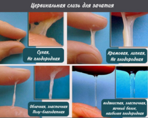 Выделение спермы (не в составе смазки) до оргазма возможно?